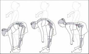 Lumbopelvic Rotation Lumbopelvic Rhythm & Lower Back Pain in Gymnasts