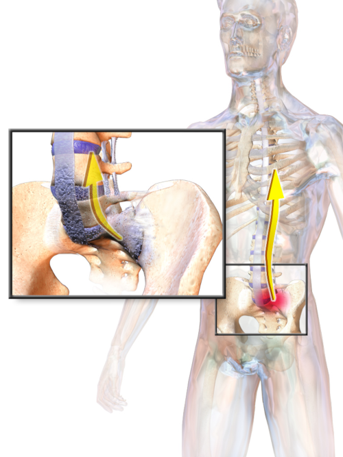 Physical Therapy for Ankylosing Spondylitis Capital Area PT & Wellness